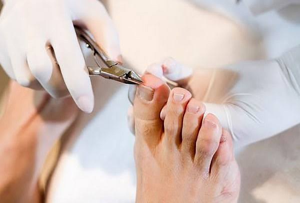 Profesional de salud realizando corte de uñas del pie con guantes